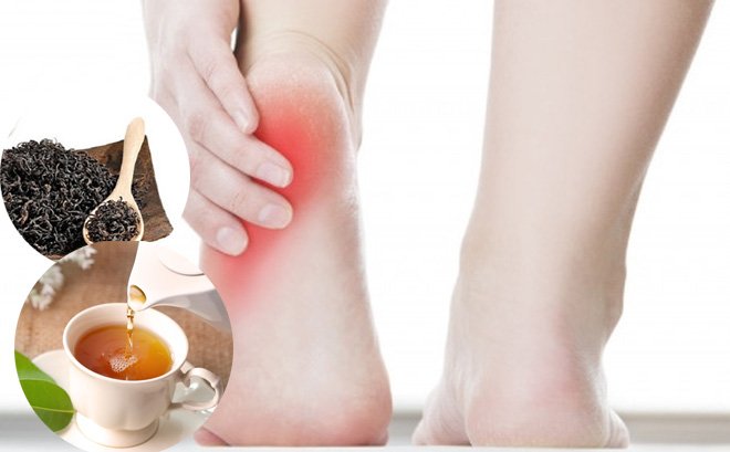 Trà hỗ trợ điều trị gout