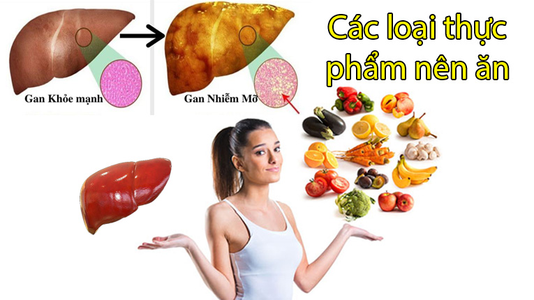 Các loại thực phẩm nên ăn