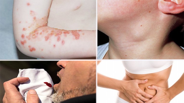 Công dụng cây ngô đồng