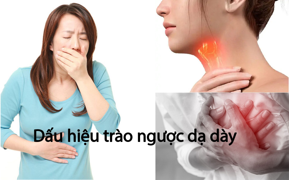 Dấu hiệu