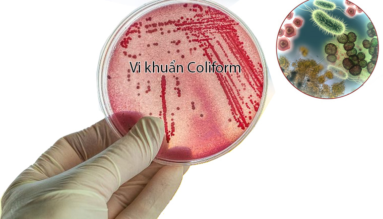 Vi khuẩn Coliform