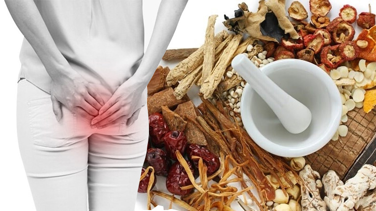 Những bài thuốc đông y chữa bệnh trĩ