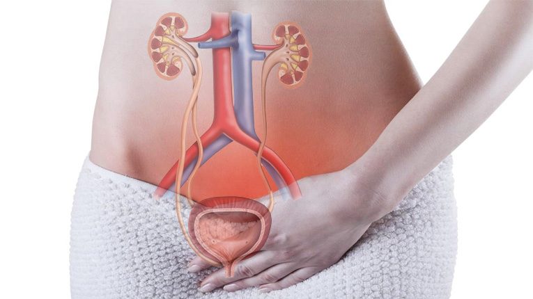 Viêm đường tiết niệu là gì?
