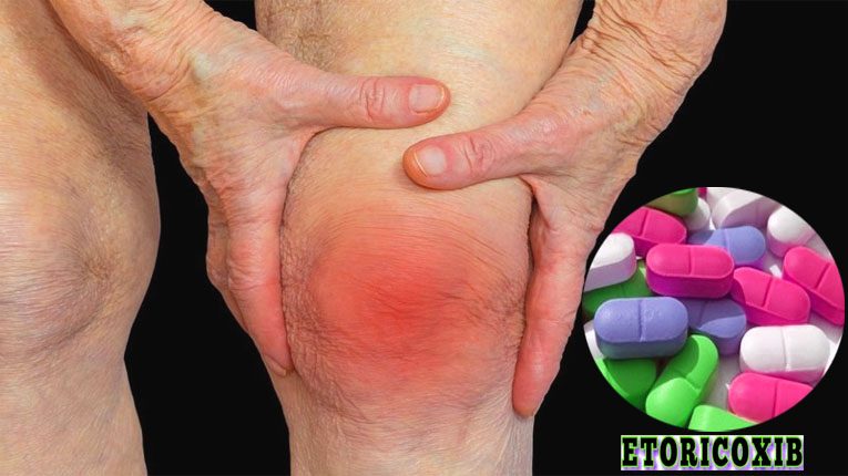 Etoricoxib là thuốc gì?